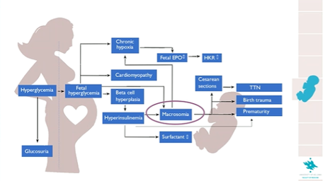 EASD 2020 La importancia del control del embarazo en la diabetes EASD 2020 La importancia del control del embarazo en la diabetes