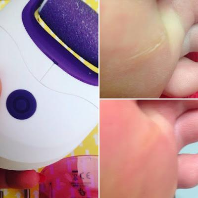 EvaFarma, pedisilk, lima electrica, lima + accesorios, manicura - pedicura, lima y accesorios, accesorios manicura, pedicura, manicura, manicure, pedicure, nail art, pies, manos, lima de uñas, blogger alicante, solo yo, blog solo yo, beauty blogger, beauty youtuber, influencer, lima electrónica,