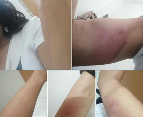 Denuncia: La intentan secuestrar en Los Olivos y logra escapar