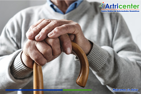 Artritis reumatoide y los dispositivos de apoyo Artritis reumatoide y los dispositivos de apoyo