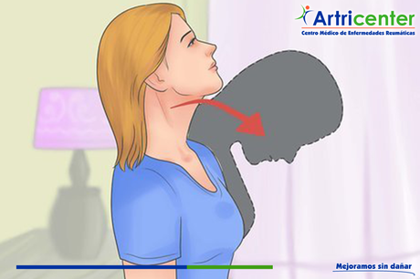 Espondilitis anquilosante y ejercicios cervicales