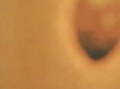 Invisible Durazno Sangrando (1975)
