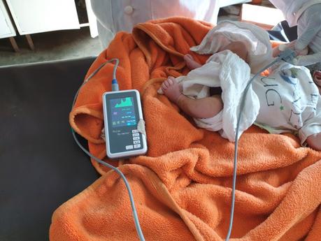 La primera UCI Neonatal rural en el Hospital de Gambo, Etiopía