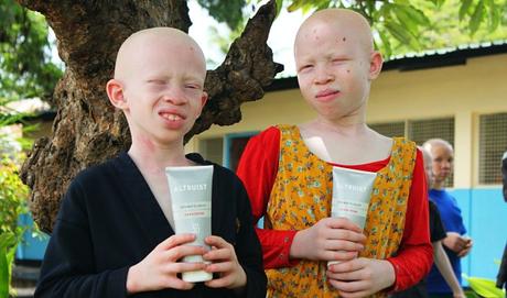 niños-albinos-africa