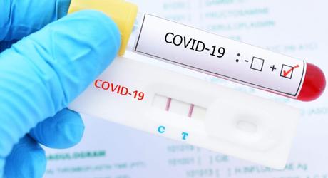 Nuevas medidas para Andalucia y todos sus municipios.