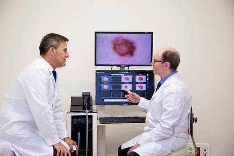 COMO SABER SI TU LUNAR ES UN CANCER DE PIEL