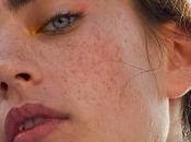 Manteniendo Raya Maskné Rutina Cuidado Biotherm