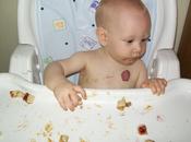 Propranolol para tratamiento hemangiomas infantiles