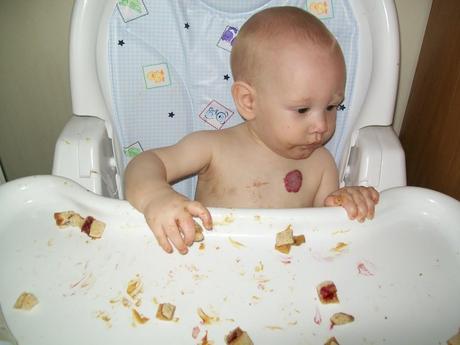 Propranolol para el tratamiento de hemangiomas infantiles