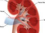 Enfermedad renal España