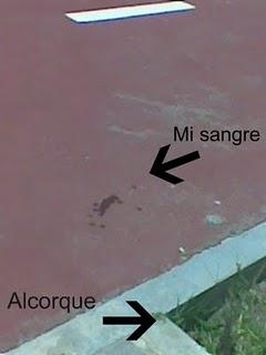 Alcorque