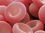 Anemias