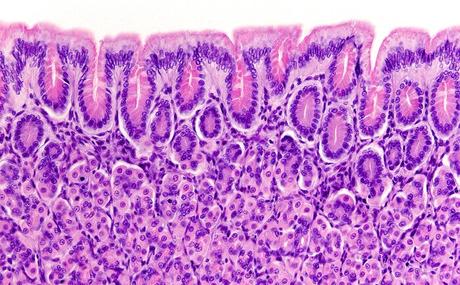 4 claves para apoyar la salud intestinal Células caliciformes