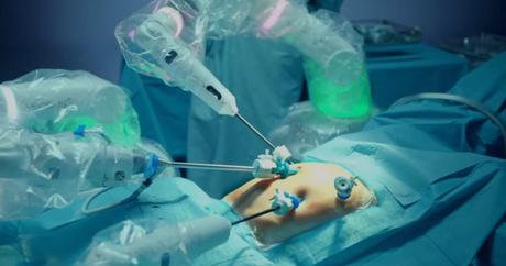 El sistema de cirugía robótica utilizado en Europa completa 1.000 operaciones