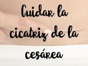 Cuidar cicatriz cesárea