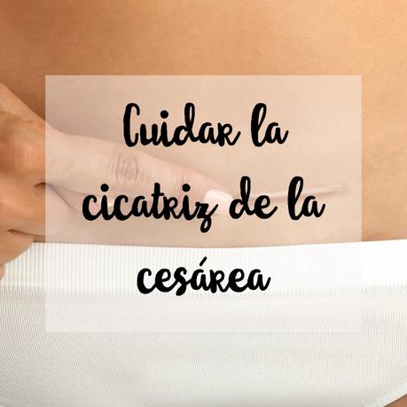 Cuidar la cicatriz de la cesárea Cuidar la cicatriz de la cesárea