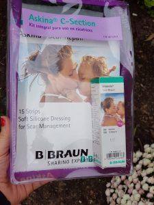 Cuidar la cicatriz de la cesárea Cuidar la cicatriz de la cesárea