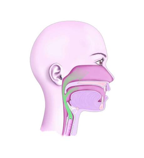 tratamiento rinolalia