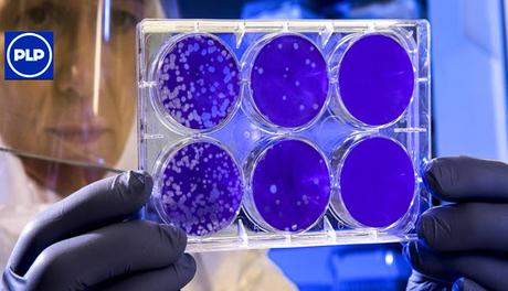 QUÉ SABES DE LA NUEVA  CEPA DEL COVID-19?