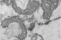 El ADN mitocondrial de los pacientes con COVID-19 predice su Gravedad El ADN mitocondrial de los pacientes con COVID-19 predice su Gravedad