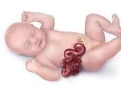 Gracias, Laia, ¡que lejos queda mala noticia gastrosquisis!