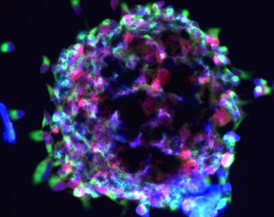 Células madre embrionarias