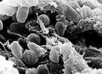 yersinia_pestis