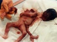 Les Fernández: desesperades por abortar