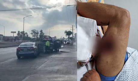 Enfrentamiento entre policías municipales y civiles en la Carretera  57: 2 heridos