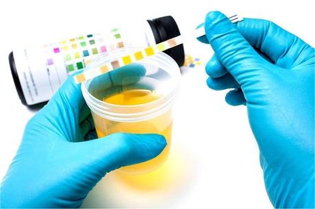 La cetona ¿mejora el rendimiento de los ciclistas?