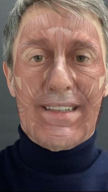 CONSEJOS PARA QUE NADIE NOTE QUE LLEVAS BOTOX