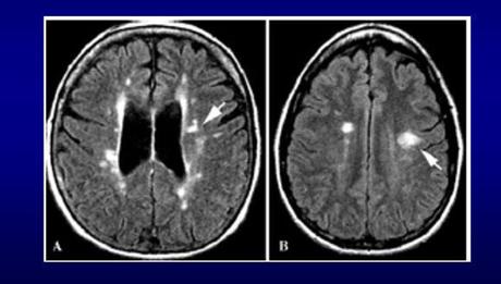 ¿Cuál será la nueva justificación médica de EEUU sobre los “ataques sónicos” en Cuba?