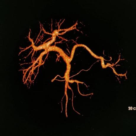 Circulación portal tac