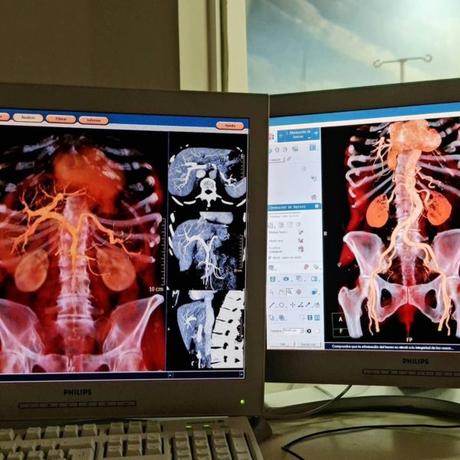 Circulación portal tac