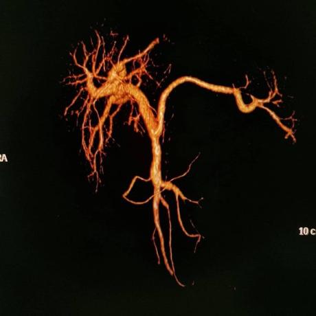 Circulación portal tac
