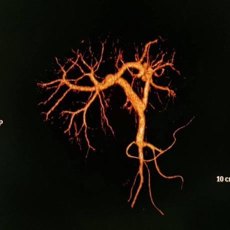Circulación portal tac