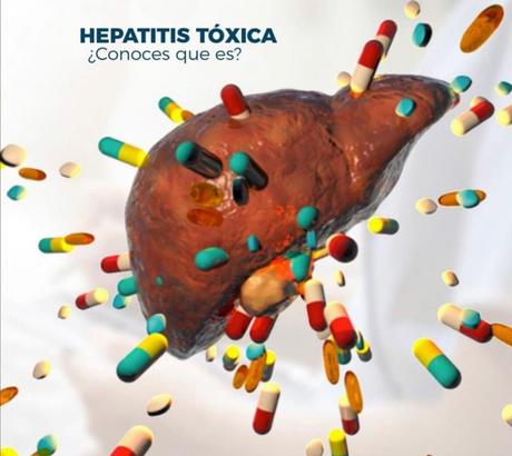 síntomas hepatitis