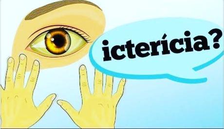 Síntomas de tener hepatitis y cómo prevenirla