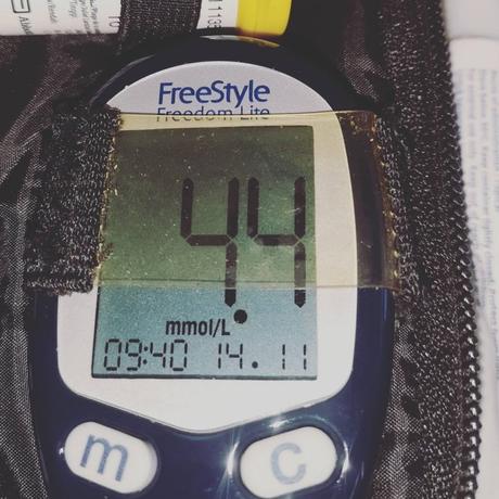 Cómo vivir con diabetes tipo 2: Te lo contamos