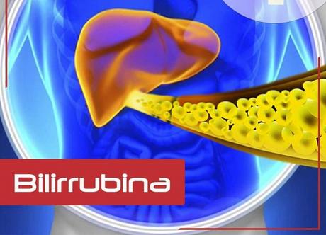 ¿Cómo se puede bajar la bilirrubina?