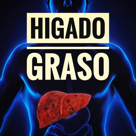 ¿Cómo se puede bajar la bilirrubina? bajar la bilirrubina