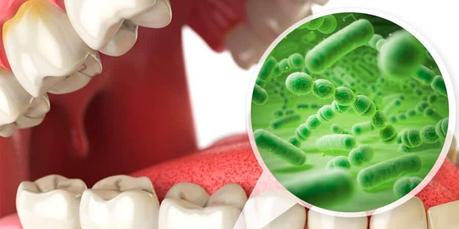 Halitosis ¿Qué la provoca y cómo combatirla? Halitosis ¿Qué la provoca y cómo combatirla?