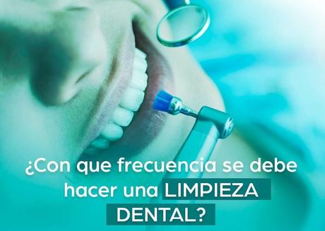 ¿Cuál es la mejor frecuencia para hacerse una higiene dental o limpieza bucal? ¿Cuál es la mejor frecuencia para hacerse una higiene dental o limpieza bucal?