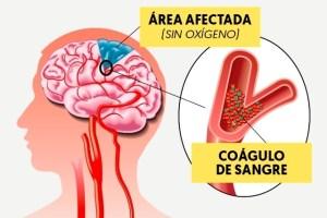 La EMA incluye los trombos en el prospecto de la vacuna para «salvarse» ella y AstraZeneca