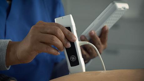 El VSCAN sirve para diagnosticar enfermedades