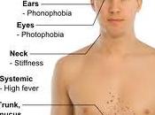 Meningitis