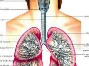 Asma Bronquial
