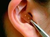 Para sirve auriculoterapia