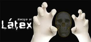 Alergia al látex: revisión