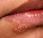 herpes para toda vida?